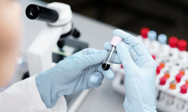 Salud sexual y prevención 4